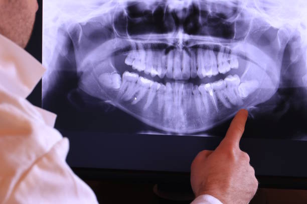 Best Emergency Treatment for Dental Infections or Abscesses in Josephine, TX